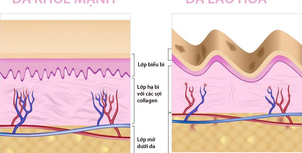 collagen-la-gi(1)