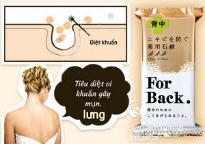 Xa-Phong-Tri-Mun-Lung-For-Back-Medicated-Soap-Pelican-4