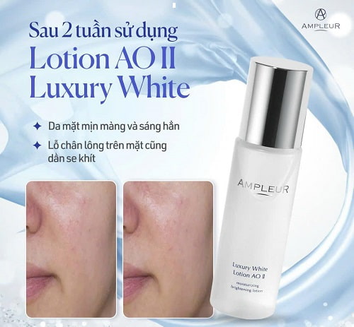 Nước hoa hồng Ampleur Luxury White Lotion AO II review-6